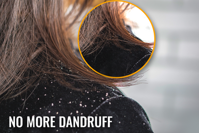 7 Tips to Get Rid Of Dandruff