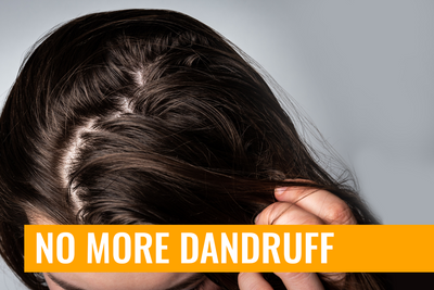 Some Effective Ways to Get Rid of Dandruff Naturally