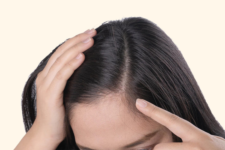 Banish the Flakes - Your Comprehensive Guide to Dandruff Shampoos