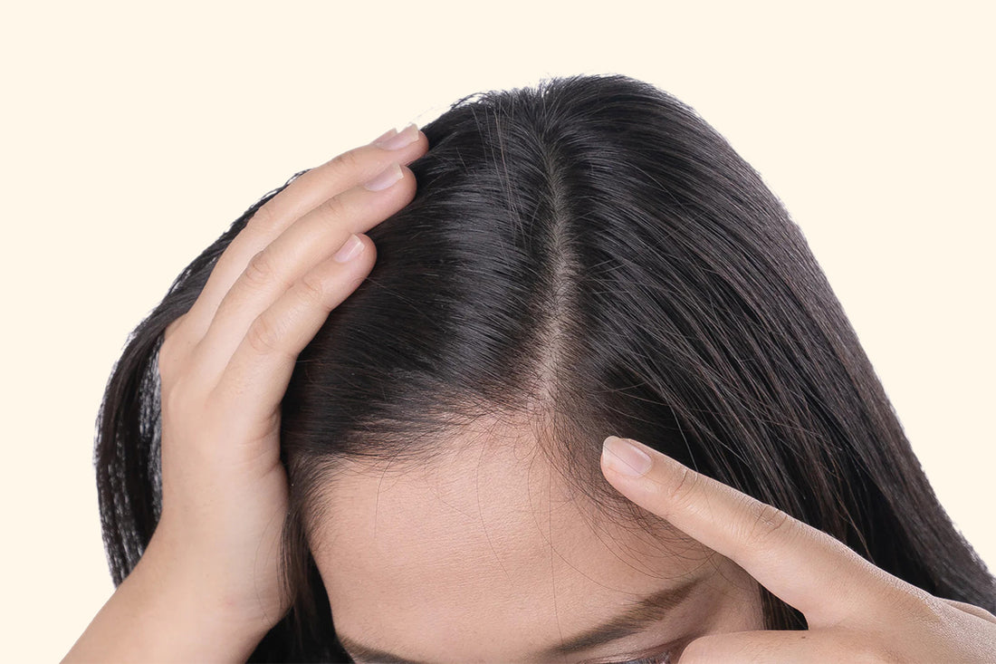 Banish the Flakes - Your Comprehensive Guide to Dandruff Shampoos