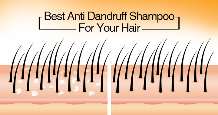 Best Anti-Dandruff Shampoo