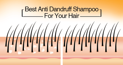 Best Anti-Dandruff Shampoo For Your Hair