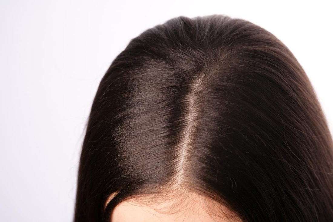 How does Anti Dandruff Shampoo work?